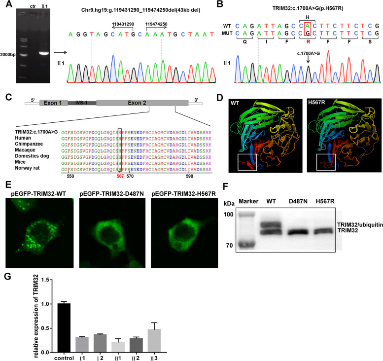 TRIM32 biallelic defects cause limb-girdle muscular dystrophy R8: identification of two novel mutations and investigation of genotype-phenotype correlation.