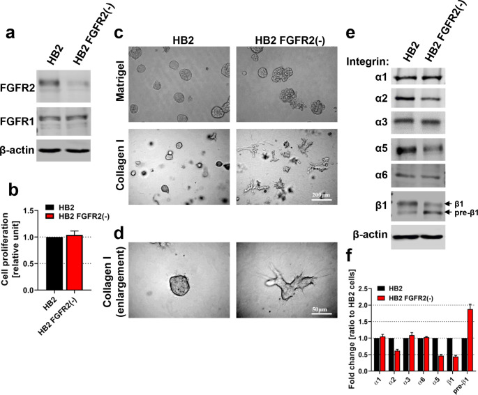 FGFR2 Controls Growth, Adhesion and Migration of Nontumorigenic Human Mammary Epithelial Cells by Regulation of Integrin β1 Degradation.