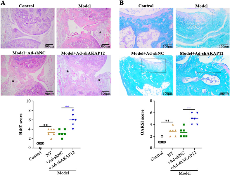 Loss of AKAP12 aggravates rheumatoid arthritis-like symptoms and cardiac damage in collagen-induced arthritis mice.