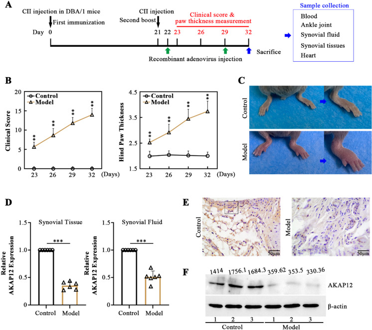 Loss of AKAP12 aggravates rheumatoid arthritis-like symptoms and cardiac damage in collagen-induced arthritis mice.