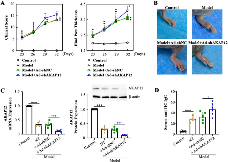 Loss of AKAP12 aggravates rheumatoid arthritis-like symptoms and cardiac damage in collagen-induced arthritis mice.