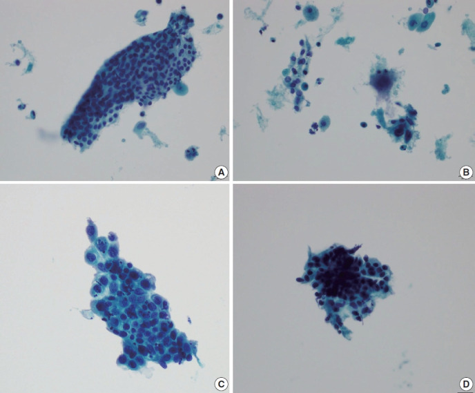 Trouble-makers in cytologic interpretation of the uterine cervix.