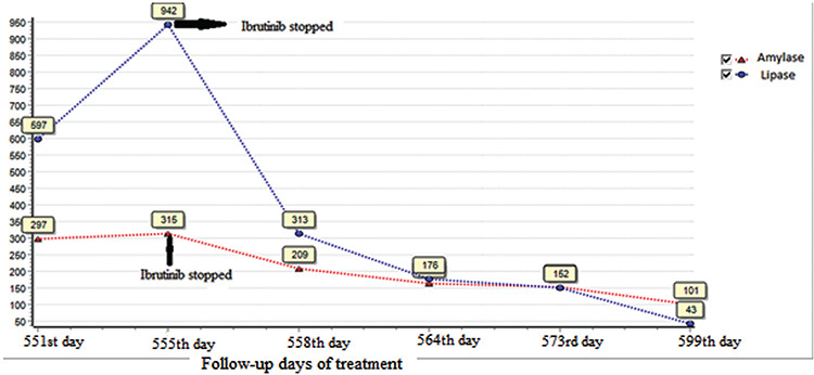 Ibrutinib-Induced Pancreatitis in Patients with Waldenstrom Macroglobulinemia