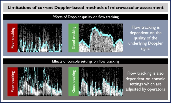 Development of artificial intelligence tools for invasive Doppler-based coronary microvascular assessment.