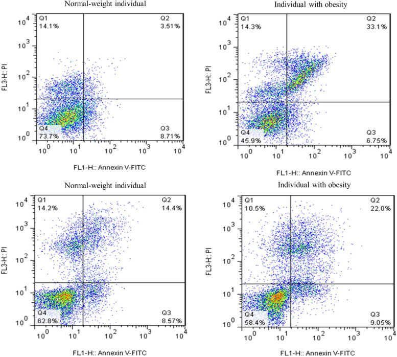 Male obesity is associated with sperm telomere shortening and aberrant mRNA expression of autophagy-related genes.