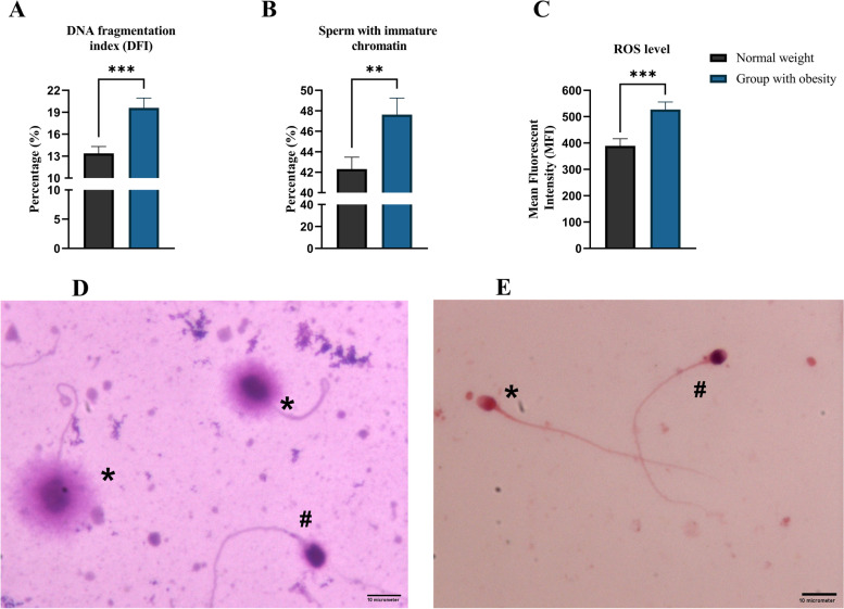 Male obesity is associated with sperm telomere shortening and aberrant mRNA expression of autophagy-related genes.