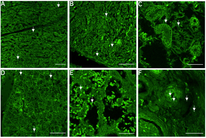 Placental-fetal distribution of carbon particles in a pregnant rabbit model after repeated exposure to diluted diesel engine exhaust.