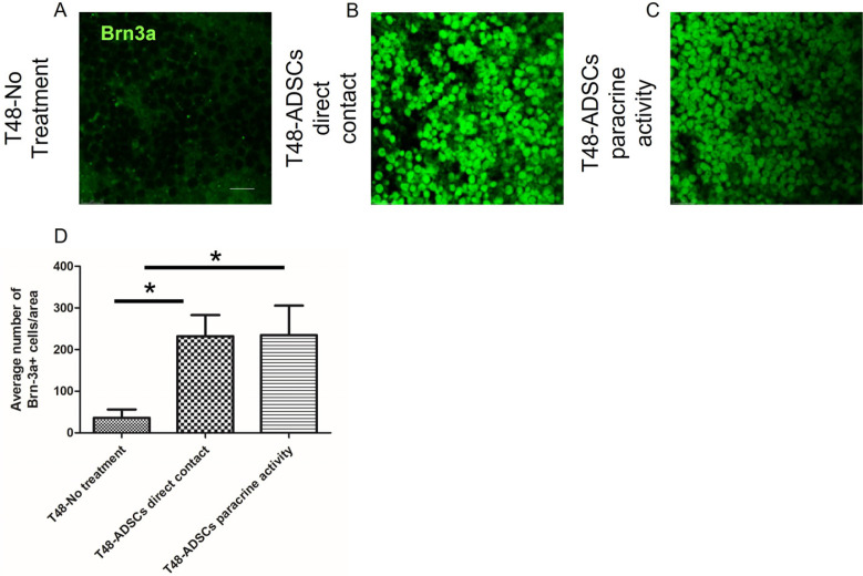 Regenerative Effect of Adipose Derived Mesenchymal Stem Cells on Ganglion Cells in the Hypoxic Organotypic Retina Culture.