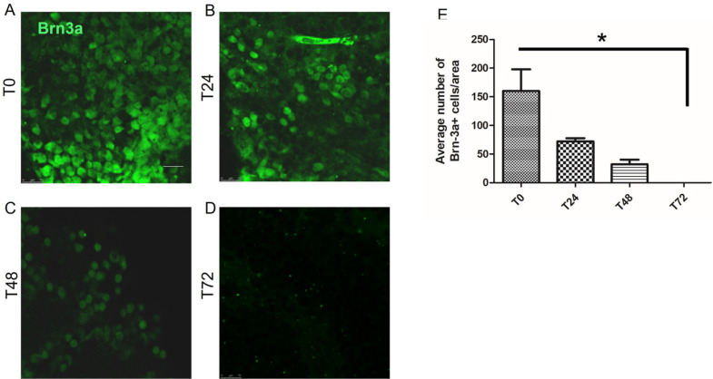 Regenerative Effect of Adipose Derived Mesenchymal Stem Cells on Ganglion Cells in the Hypoxic Organotypic Retina Culture.