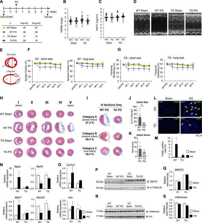 SMYD1a protects the heart from ischemic injury by regulating OPA1-mediated cristae remodeling and supercomplex formation.