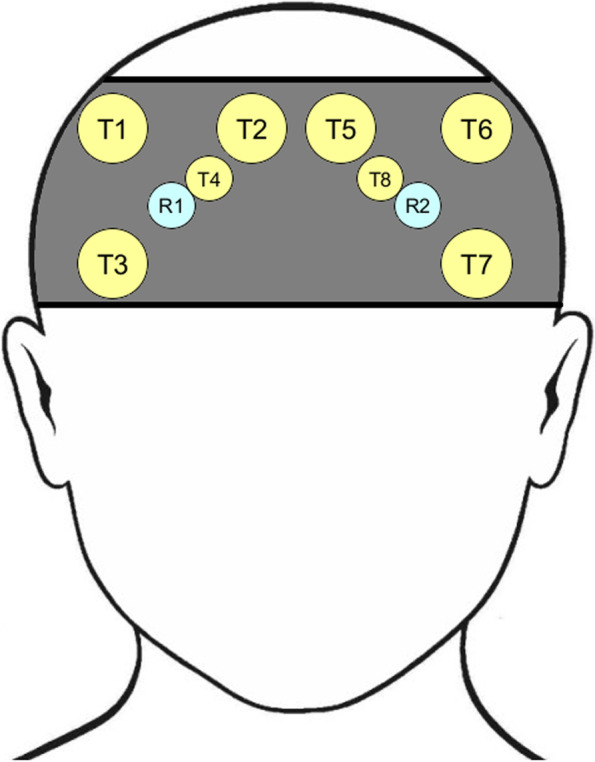 Measuring cognitively demanding activities in pediatric out-of-hospital cardiac arrest.