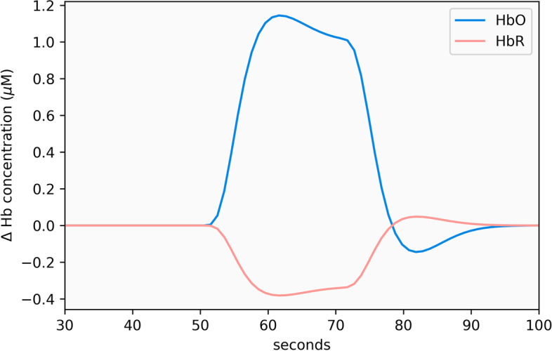 Measuring cognitively demanding activities in pediatric out-of-hospital cardiac arrest.