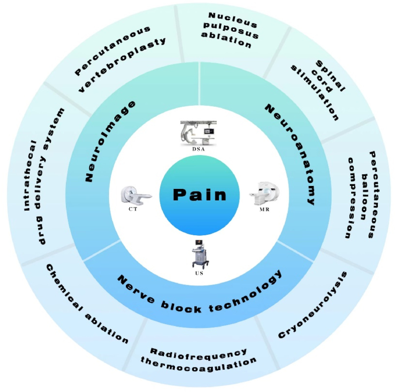 Minimally invasive interventional therapy for pain