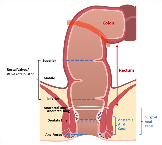 [Perianal Fistula: An Overview].