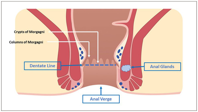 [Perianal Fistula: An Overview].