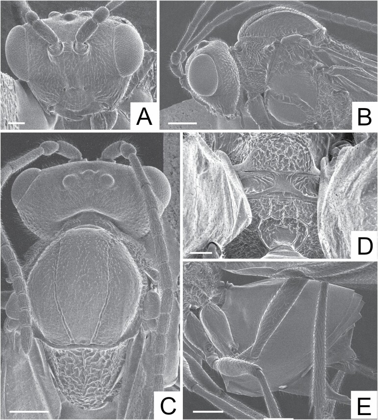 Extinction Threat to a Previously Undescribed Species of Gall Wasp (Hymenoptera: Cynipidae) and Two Associated Parasitoid Species (Hymenoptera: Braconidae and Eulophidae) on a Threatened Rose.