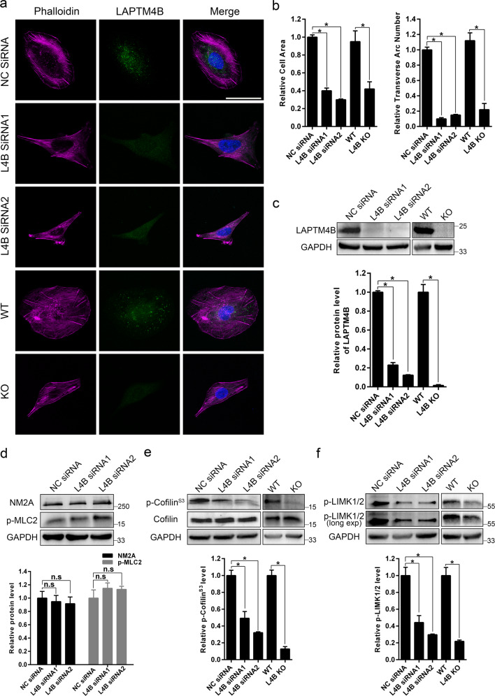 miR-137-LAPTM4B regulates cytoskeleton organization and cancer metastasis via the RhoA-LIMK-Cofilin pathway in osteosarcoma.