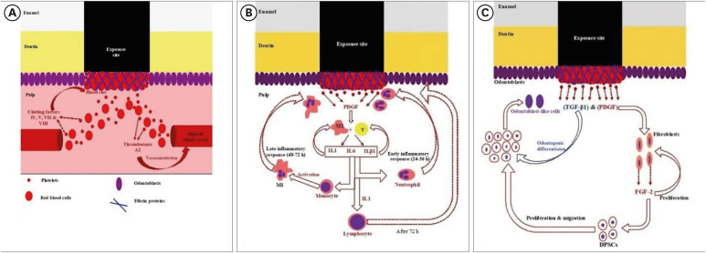 Stem cell-derived exosomes for dentin-pulp complex regeneration: a mini-review.