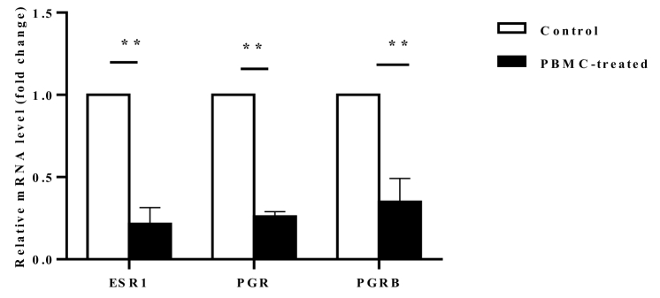 Intrauterine administration of autologous peripheral blood mononuclear cells regulates the endometrium estrogen and progesterone receptor expression: An RCT.