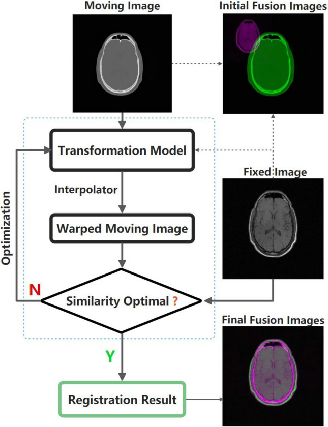 Normal vibration distribution search-based differential evolution algorithm for multimodal biomedical image registration.