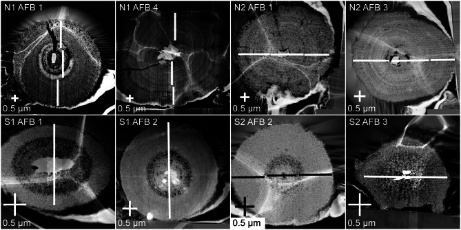 An investigation of the internal morphology of asbestos ferruginous bodies: constraining their role in the onset of malignant mesothelioma.