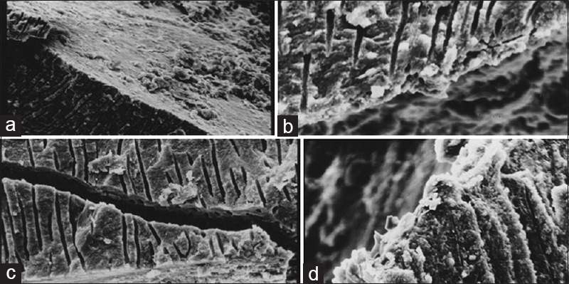 Comparative evaluation of cleaning efficiency of single file NiTi rotary system during root canal treatment procedure - A scanning electron microscope study.