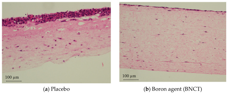 Development of the Follow-Up Human 3D Oral Cancer Model in Cancer Treatment.