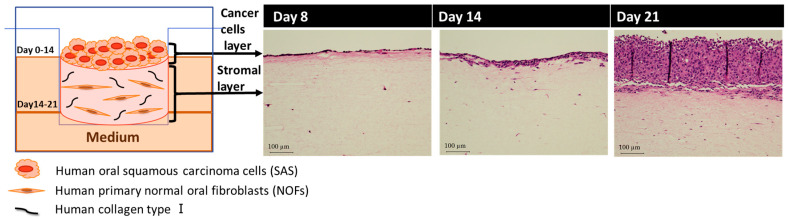 Development of the Follow-Up Human 3D Oral Cancer Model in Cancer Treatment.