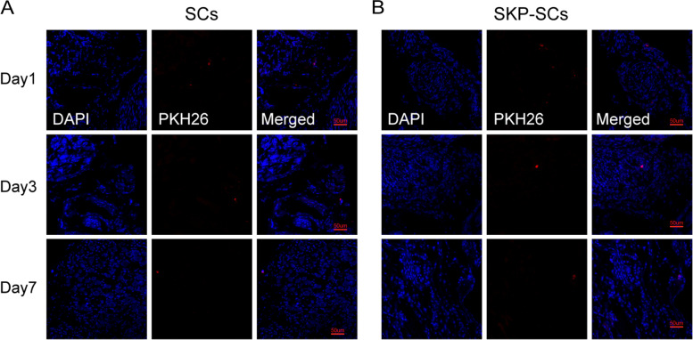 Implantation of skin-derived precursor Schwann cells improves erectile function in a bilateral cavernous nerve injury rat model.