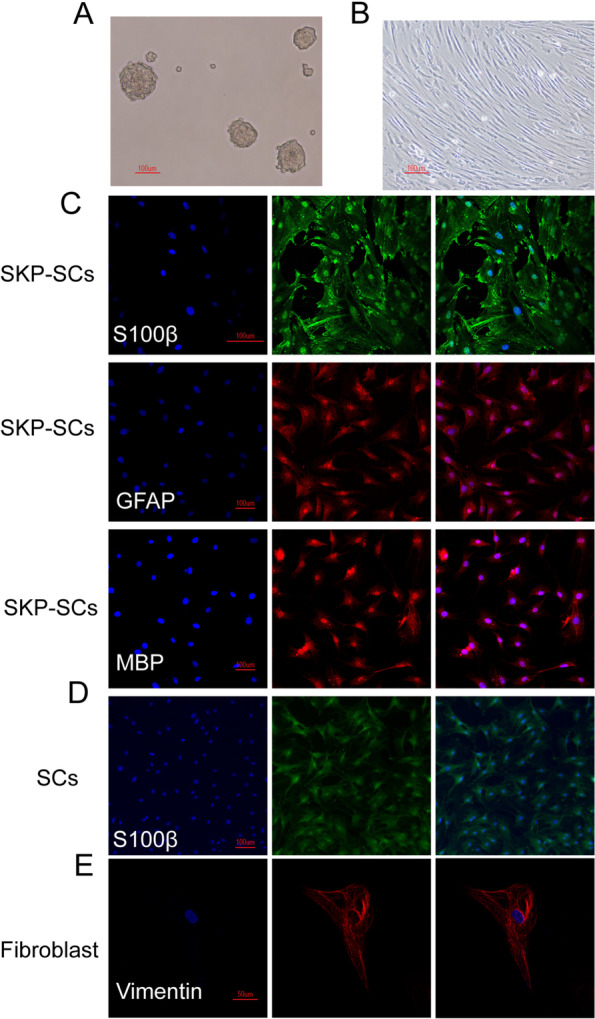 Implantation of skin-derived precursor Schwann cells improves erectile function in a bilateral cavernous nerve injury rat model.