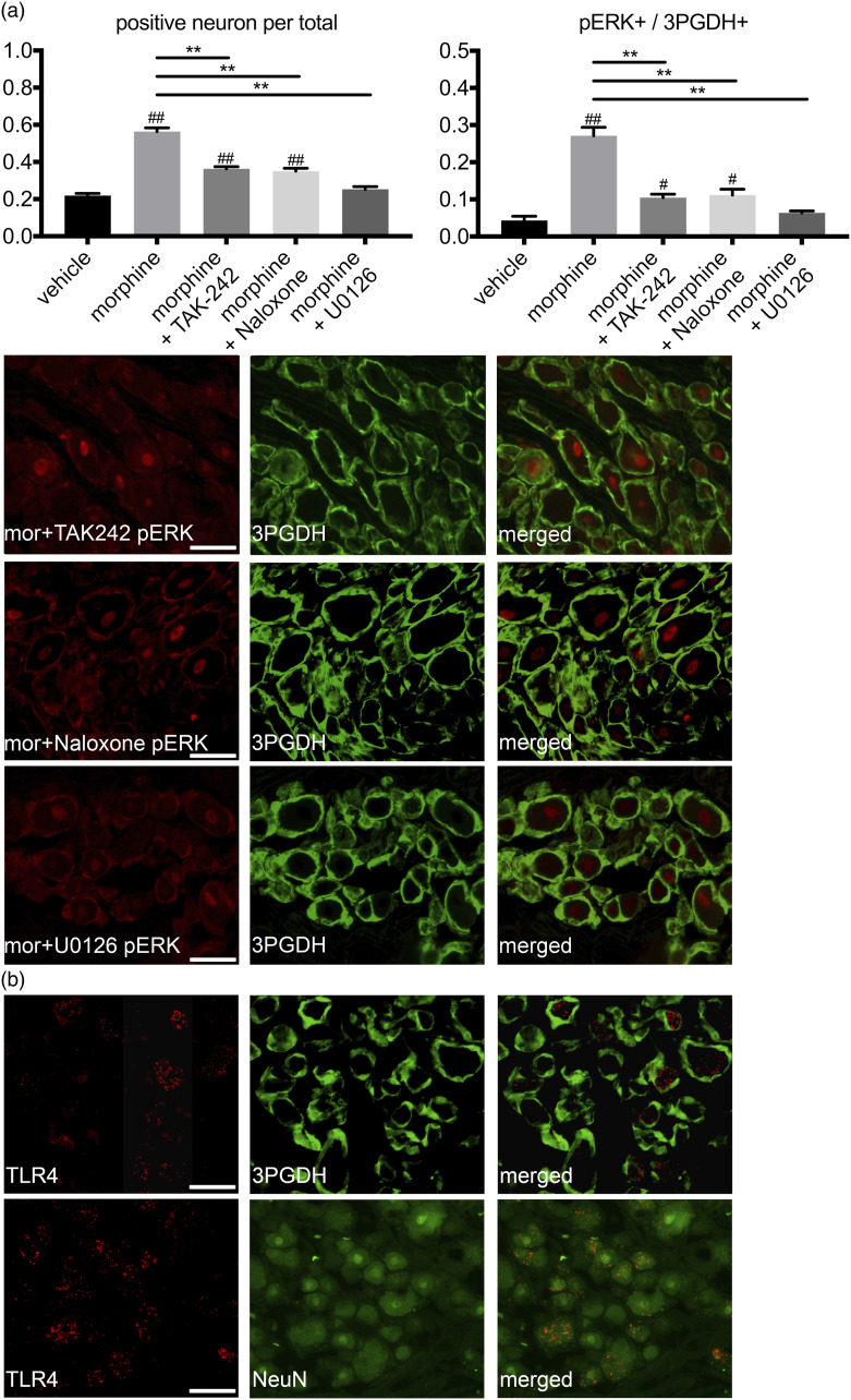 Activation of neurons and satellite glial cells in the DRG produces morphine-induced hyperalgesia.