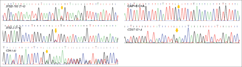 Rare and New Mutations of B-Globin in Azari Population of Iran, a Considerable Diversity.