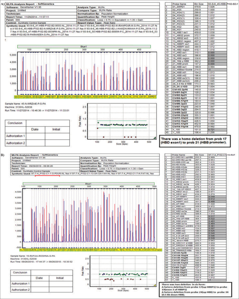 Rare and New Mutations of B-Globin in Azari Population of Iran, a Considerable Diversity.