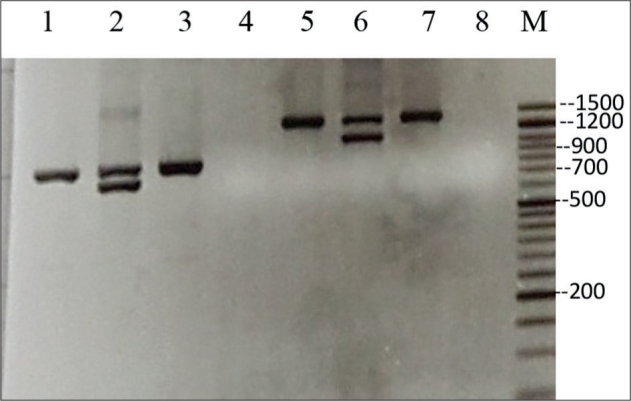 Rare and New Mutations of B-Globin in Azari Population of Iran, a Considerable Diversity.