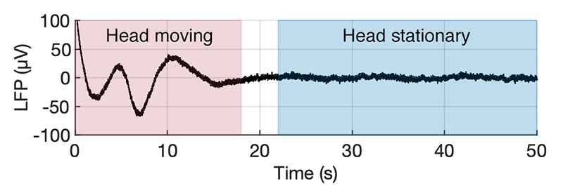 The Design of Brainstem Interfaces: Characterisation of Physiological Artefacts and Implications for Closed-loop Algorithms.