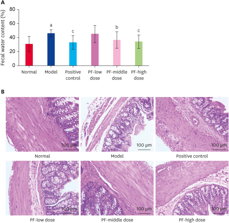 Therapeutic effects of paeoniflorin on irritable bowel syndrome in rats.