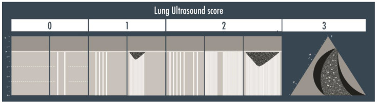 Lung Ultrasound in Critical Care and Emergency Medicine: Clinical Review.