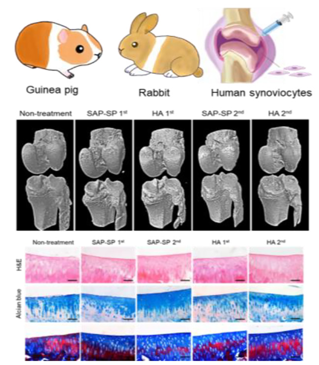 Self-assembled peptide-substance P hydrogels alleviate inflammation and ameliorate the cartilage regeneration in knee osteoarthritis.