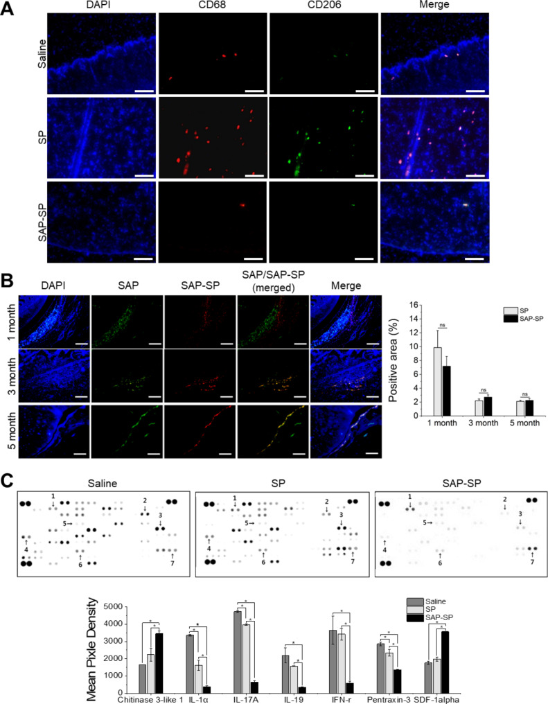 Self-assembled peptide-substance P hydrogels alleviate inflammation and ameliorate the cartilage regeneration in knee osteoarthritis.