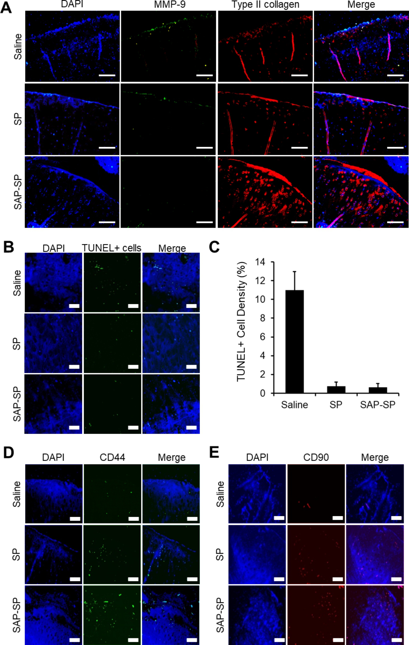 Self-assembled peptide-substance P hydrogels alleviate inflammation and ameliorate the cartilage regeneration in knee osteoarthritis.