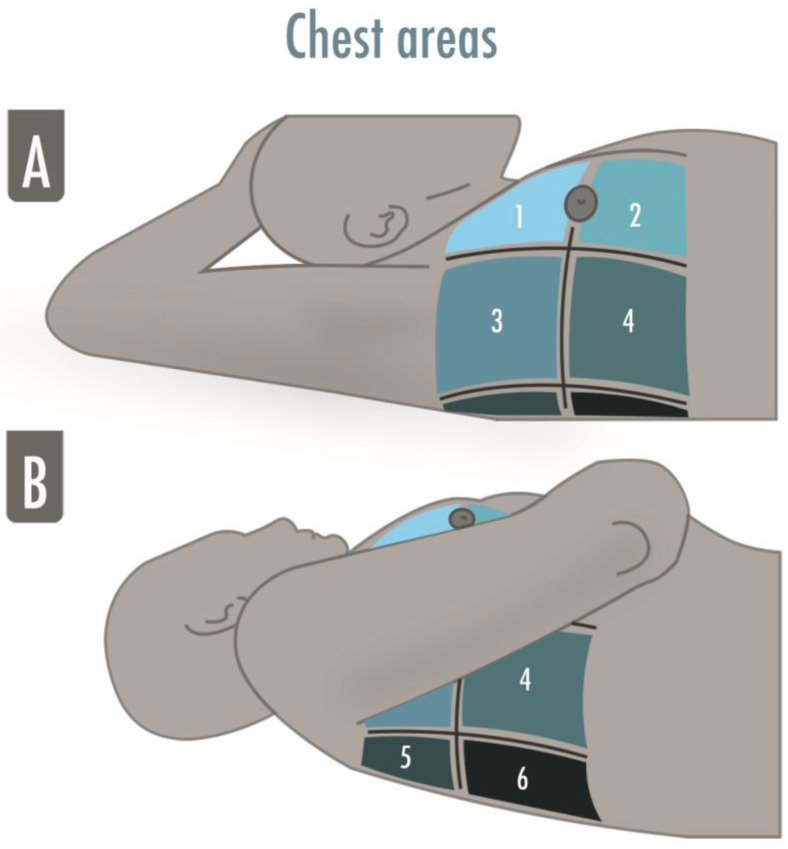 Lung Ultrasound in Critical Care and Emergency Medicine: Clinical Review.