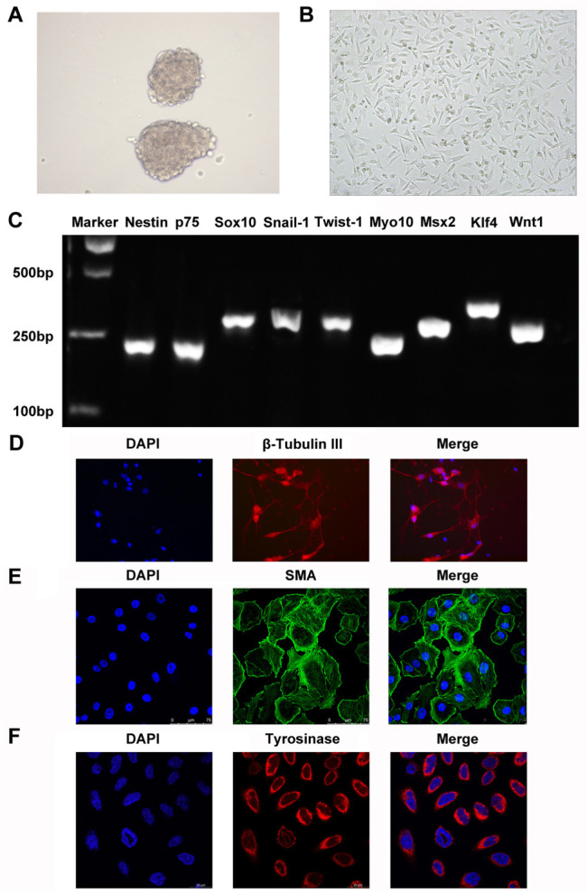 The Suppression Effects of Fat Mass and Obesity Associated Gene on the Hair Follicle-Derived Neural Crest Stem Cells Differentiating into Melanocyte by N6-Methyladenosine Modifying Microphthalmia-Associated Transcription Factor.