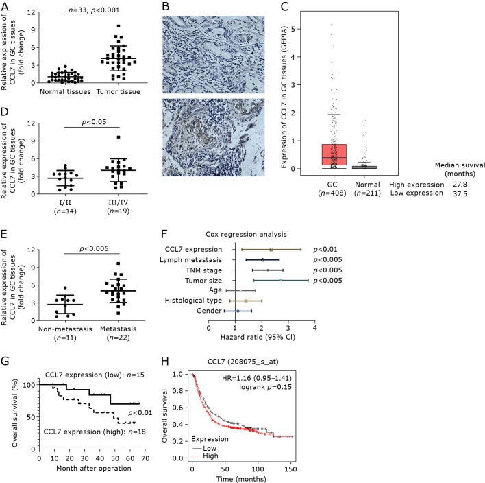 HIF1α/CCL7/KIAA1199 axis mediates hypoxia-induced gastric cancer aggravation and glycolysis alteration.