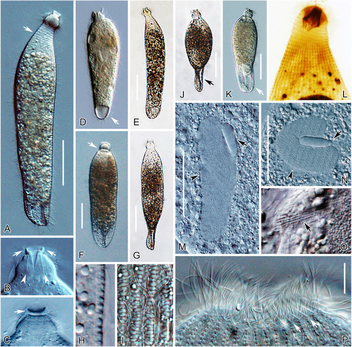 Morphological and molecular examination of the ciliate family Lagynusidae (Protista, Ciliophora, Prostomatea) with descriptions of two new genera and two new species from China.