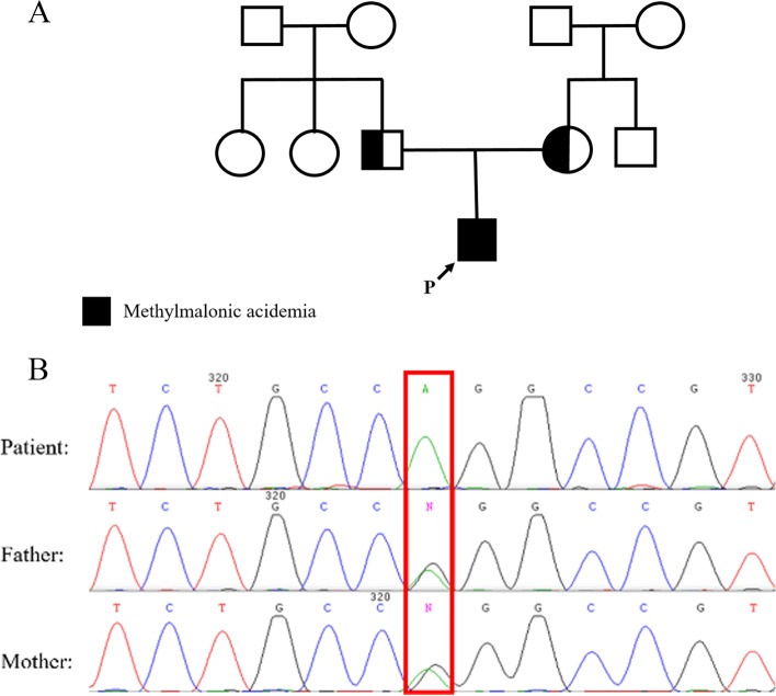 Identifying and predicting the pathogenic effects of a novel variant inducing severe early onset MMA: a bioinformatics approach.