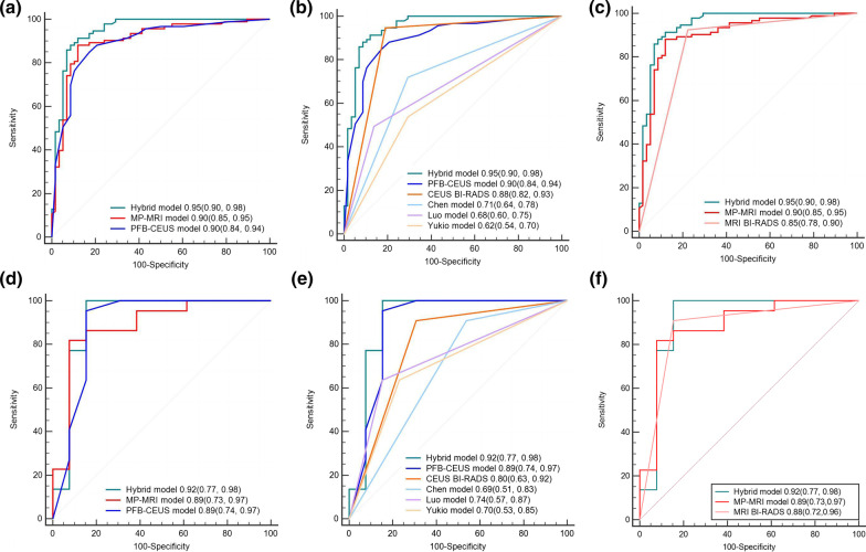 Head-to-head comparison of perfluorobutane contrast-enhanced US and multiparametric MRI for breast cancer: a prospective, multicenter study.