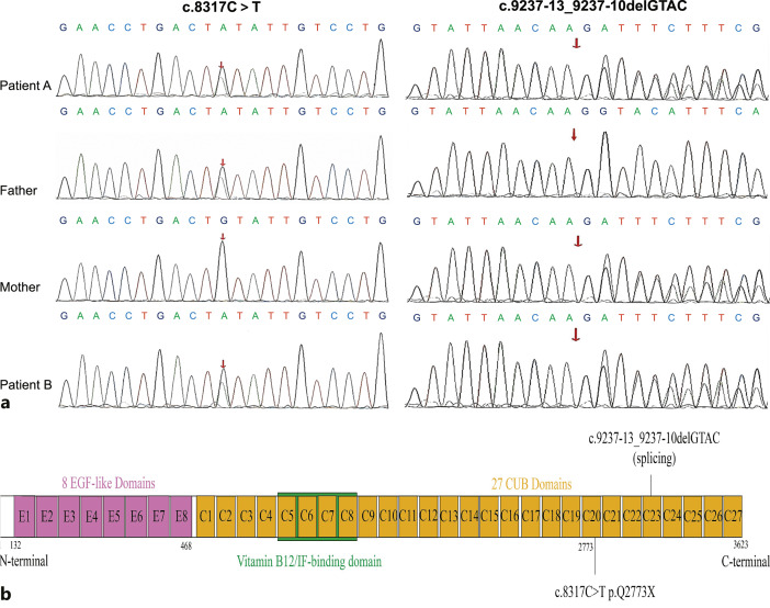 Isolated Proteinuria Caused by <i>CUBN</i> Gene Mutations: A Case Report and Review of the Literature.