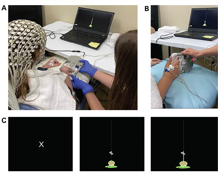 Corticomuscular Coherence in Children with Unilateral Cerebral Palsy: A Feasibility and Preliminary Protocol Study.