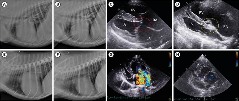 Open-heart surgery using Del-Nido cardioplegia in two dogs: partial atrioventricular septal defect and mitral repair.