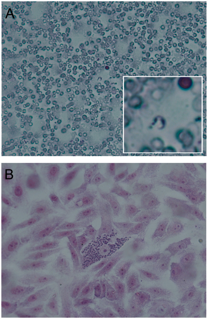 Laboratory diagnosis of <i>Trypanosoma cruzi</i> infection: a narrative review.